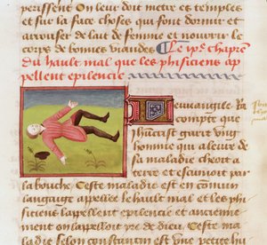 Patient suffering from an epileptic fit, from Le Livre des Proprietes des choses by Barthelemy l