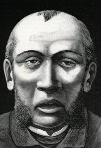 Patient with cerebral softening (engraving, 1888) by French School