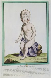 Child with a Deformed Head, from 