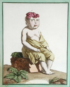 Child with half a head, from 