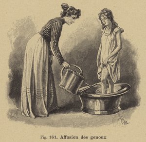 Bathing the Knees by German School