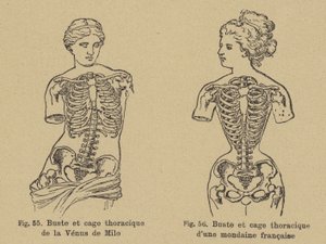 Comparison of the shape of the chest and ribcage of the Venus de Milo with that of a late 19th Century French socialite by German School
