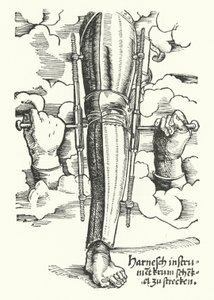 Device to Straighten a Wounded Leg by German School