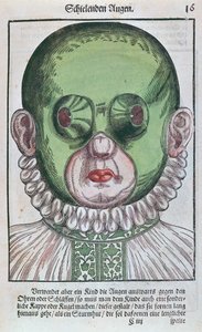 Mask for Treating a Strabismus, from Ophthalmodouleia by Georg Bartisch, published in Dresden in 1583 by German School