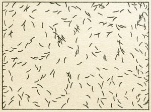 Sample of bacteria in tapwater by German School