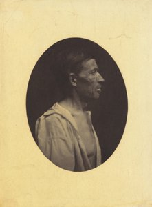 A Portrait, Seen in Profile, of a Man 42 Years Old, Stupefied by the Abuse of Alcohol; His Nose is Aquiline by Guillaume Benjamin Amant Duchenne