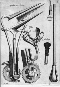 Gynecology: Plate Representing a Speculum. Engraving by Girolamo Fabricii in 