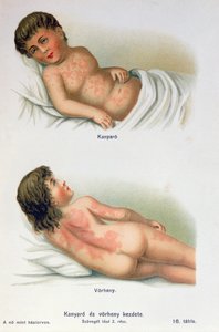 Measles and scarlet fever, from a family medical book, c.1900