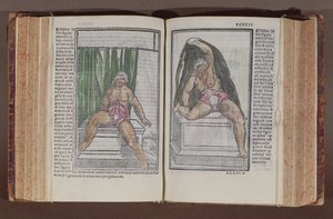 Female anatomy, from Commentaria cum amplissimis additionibus super anatomiam mundini, by Jacopo Berengario da Carpi published in Bologna, 1521