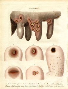 Inoculation and Disease Progression