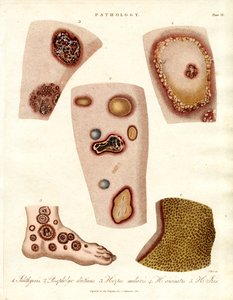 Various Skin Eruptions and Ulcers