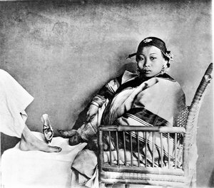 Woman showing her foot mutilated by wearing traditional shoes next to a European foot