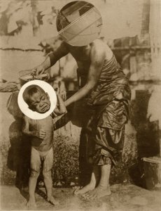 Birthmark (Salome) by Laszlo Moholy Nagy