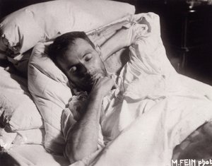 Egon Schiele on His Deathbed