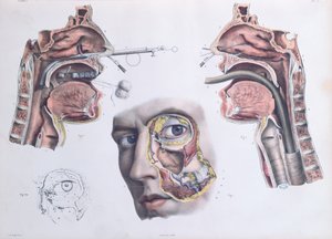 A Nasal Operation, Plate from 