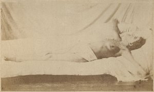 Hysterical Epilepsy, Attack, Crucifixion, Plate VI from 