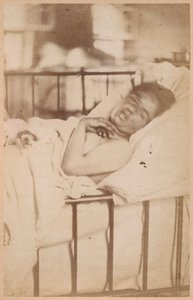 Hysterical epilepsy, permanent contraction, plate XXVIII from 