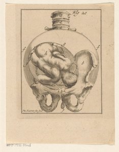 Fetus in Womb (Medical Prints on Pregnancy and Birth) by Philibert Bouttats (II)