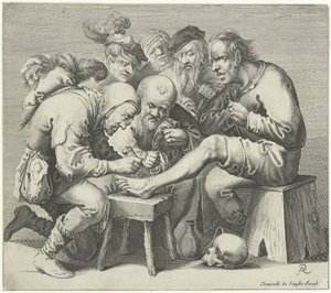 Foot Surgery by Pieter Jansz Quast