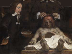 The Anatomy Lesson of Dr. Jan Deyman by Rembrandt van Rijn