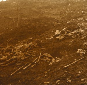 After the Attack, Les Éparges, Northern France, 1915