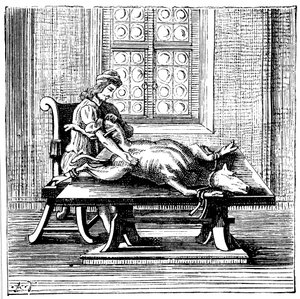 Animal-to-Human Blood Transfusion, 1679 by Unbekannt