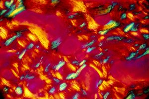 Bio-Materials, Bone