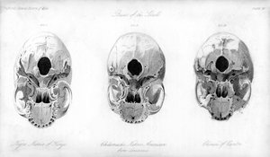 Base of the Skull