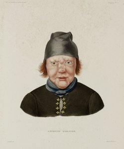 Diseases, Leprosy Female Leper, Iceland, early 19th century