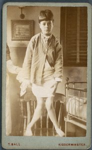 Diseases, Rickets Child with rickets by Unbekannt