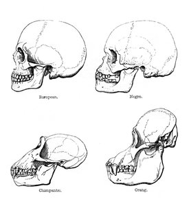 Lateral view of the skull or profile