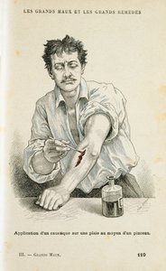 Painting a Wound with an Antiseptic Solution