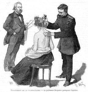 Professor Bergmann Injecting a Tuberculosis Patient