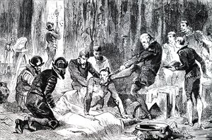 Ambroise Pare Removing a Lance from the Face of the Duc de Guise by Unbekannt