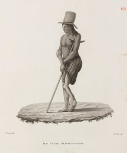 Diseases, Tropical Diseases Man with elephantiasis, Guam by Unbekannt