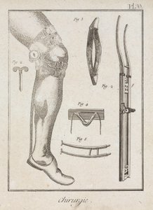 Early-Modern Surgical Supports by Unbekannt