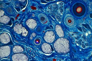 Human skin seen under a microscope, showing hair shaft and sweat pores ©Spike Walker (Microworld Services)/Dorling Kindersley/UIG/Leemage