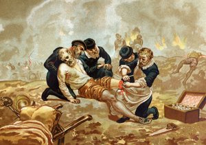 Ambroise Pare Medic and French surgeon (c. 1509-1590) practices ligation of arteries after amputation. from 