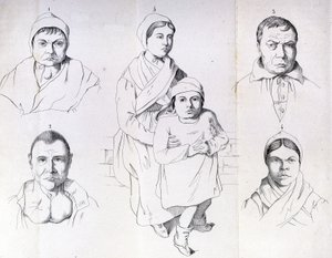 Considerations on the causes of endemic cretinism by Morel