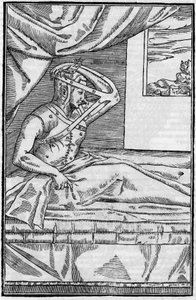 Nose surgery: Reconstructive surgery on the nose in De curtorum chirurgia per insitionem. Venice by Unknown artist