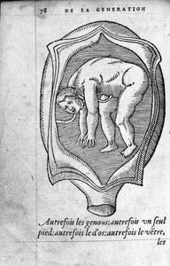 The Position of the Fetus in the Uterus