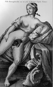 Hermaphrodite Girl Seen in 1751 and Drawn from Nature
