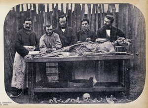 Dissection, c.1865 by Unknown photographer