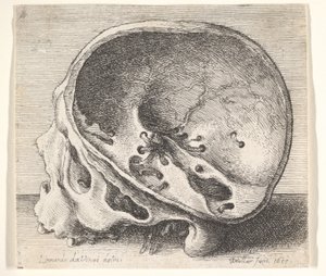 Sectioned Skull in Profile to Left with the Left Side of the Cranium Removed by Wenceslaus Hollar