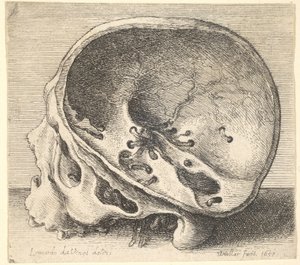 Sectioned Skull in Profile to Left with the Left Side of the Cranium Removed by Wenceslaus Hollar
