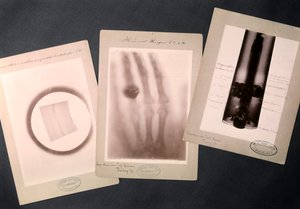 Original Radiographies by Roentgen by Wilhelm (after) Röntgen