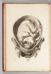 Engraving of a Child in the Womb from 