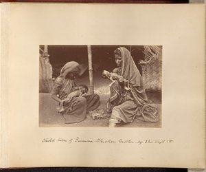 Child Born of Famine-Stricken Mother - Age: 3 months, Weight: 3 lbs. by Willoughby Wallace Hooper