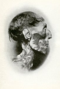 Head of the Mummy of Rameses II, Ancient Egyptian Pharaoh of the 19th Dynasty, c. 1212 BC, 1926