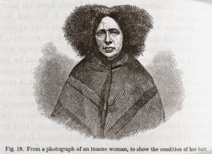 Psychiatry Insane woman by Frederick (attr. to) Barnard